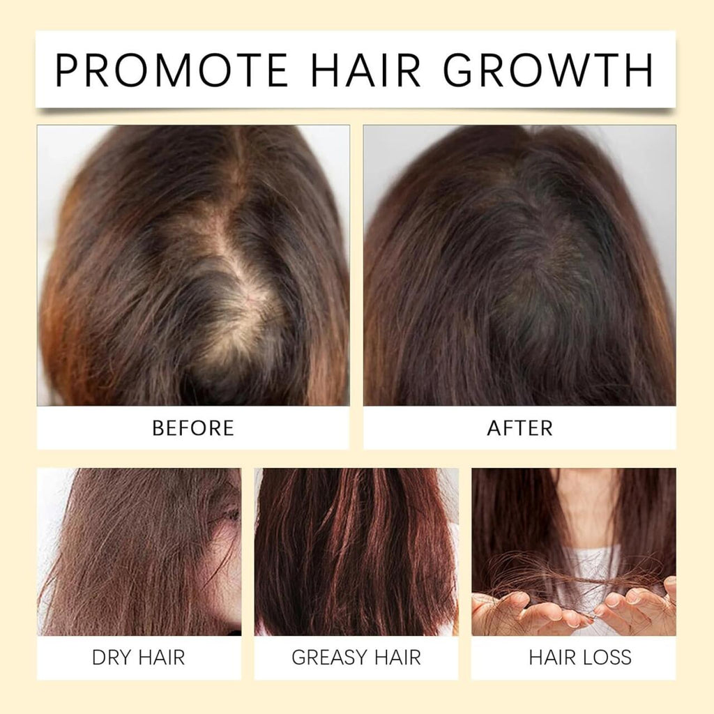 Batana Boost Hair Oil – Aceite Natural para Crecimiento, Hidratación y Brillo del Cabello Dañado