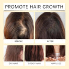 Batana Boost Hair Oil – Aceite Natural para Crecimiento, Hidratación y Brillo del Cabello Dañado