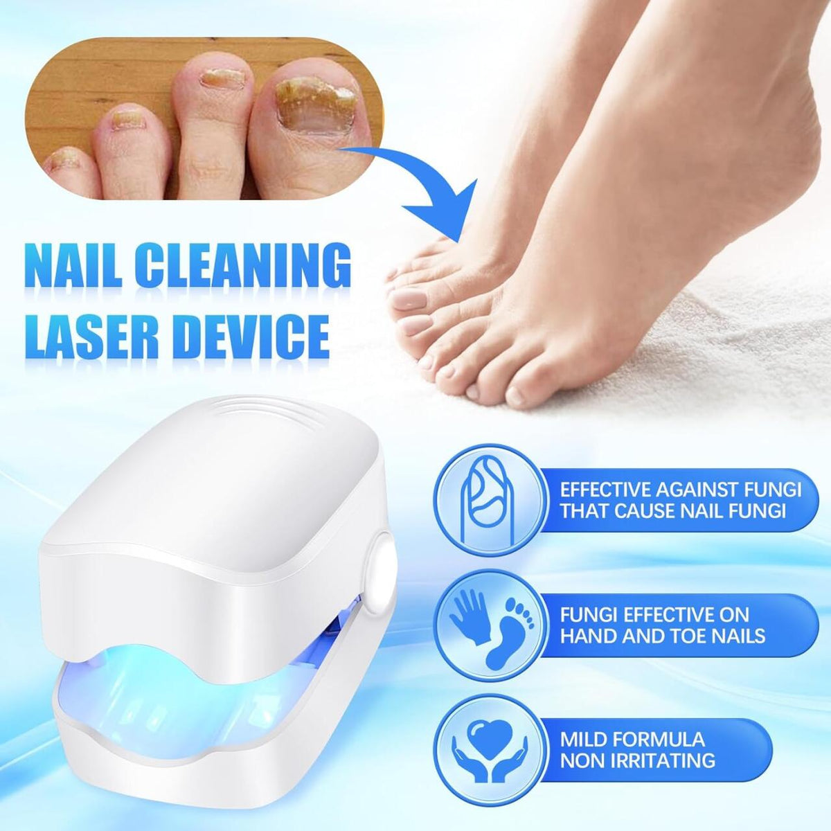 Dispositivo Láser para Tratamiento de Hongos Uñas