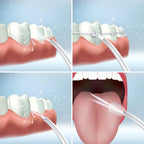 Irrigador Dental Recargable Portátil Denter para Limpieza Bucal Profunda
